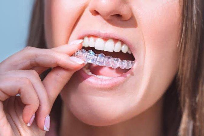 Can Invisalign Fix an Overbite, Underbite, or Crossbite? | Articles | Valley View Dental | Gan Jing World - Technology for Humanity | Video & Movie Streaming